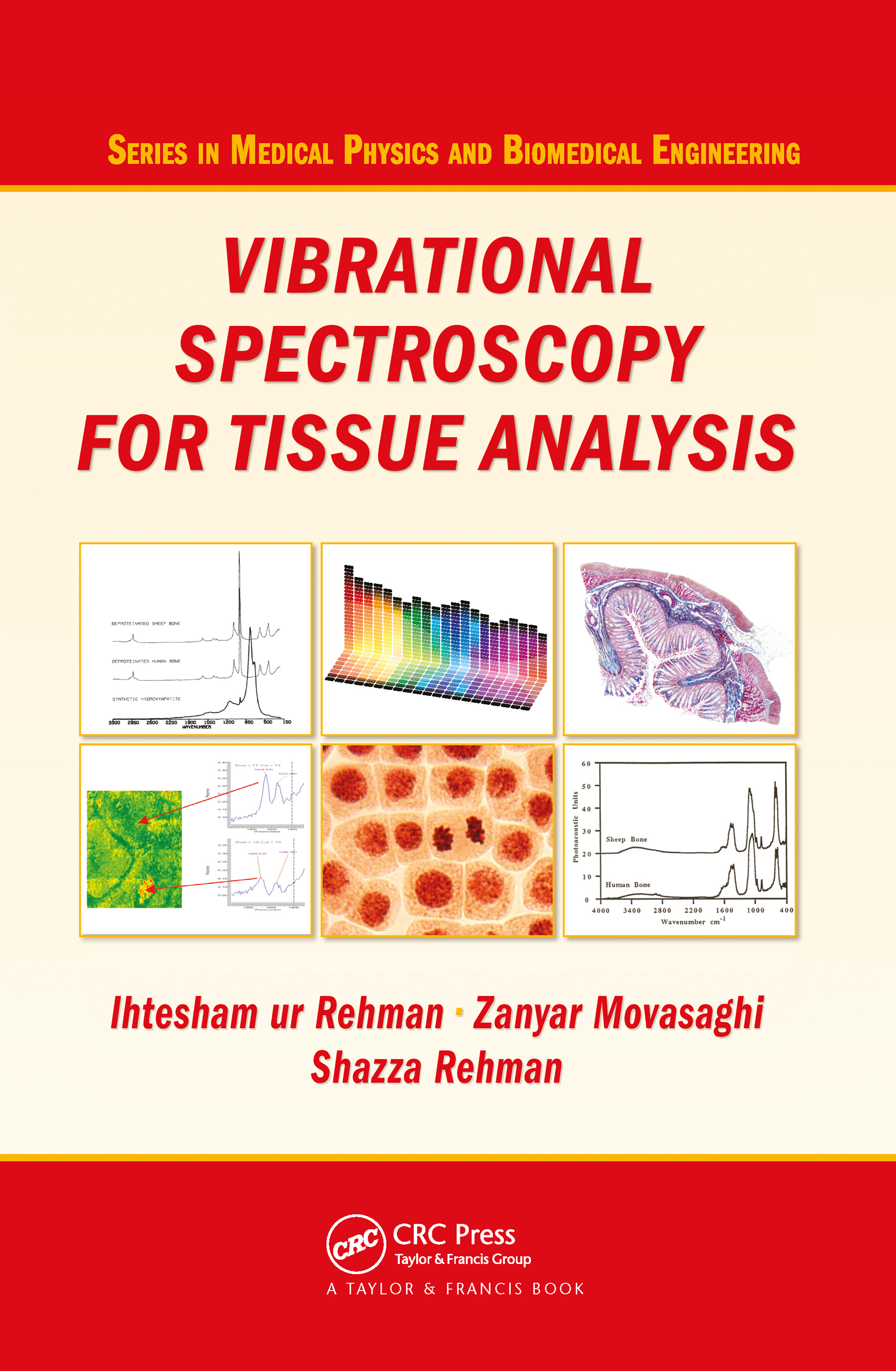 Vibrational Spectroscopy for Tissue Analysis: (Series in Medical Physics and Biomedical Engineering)
