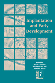 Implantation and Early Development: (Royal College of Obstetricians and Gynaecologists Study Group)