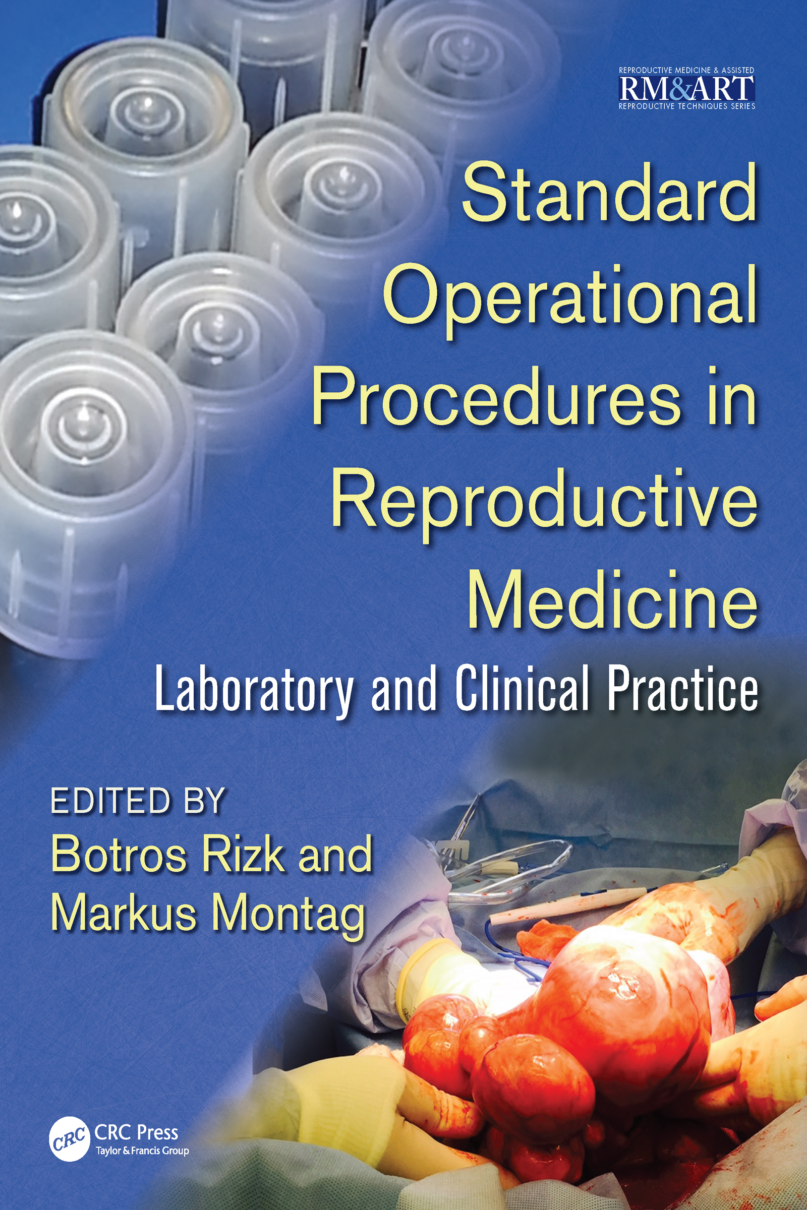 Standard Operational Procedures in Reproductive Medicine: Laboratory and Clinical Practice(Reproductive Medicine and Assisted Reproductive Techniques Series)