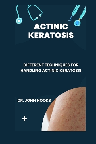 Actinic Keratosis: Different Techniques for Handling Actinic Keratosis