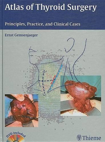 Atlas of Thyroid Surgery