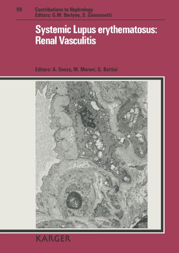 Systemic Lupus erythematosus: Renal Vasculitis: 2nd Seminar on Renal Involvement in Systemic Vasculitis, Vimercate, September 1991(99 Contributions to Nephrology)