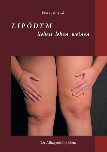 Lipödem - lieben leben weinen: Der Alltag mit Lipödem
