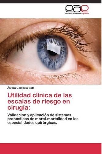 Utilidad clínica de las escalas de riesgo en cirugía