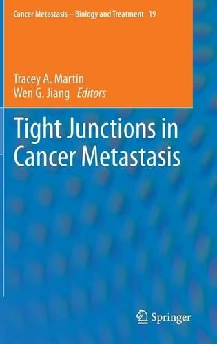 Tight Junctions in Cancer Metastasis