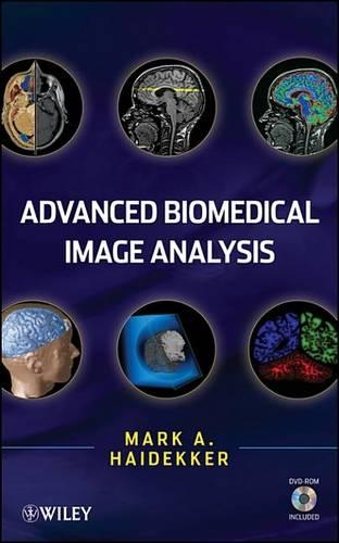 Advanced Biomedical Image Analysis