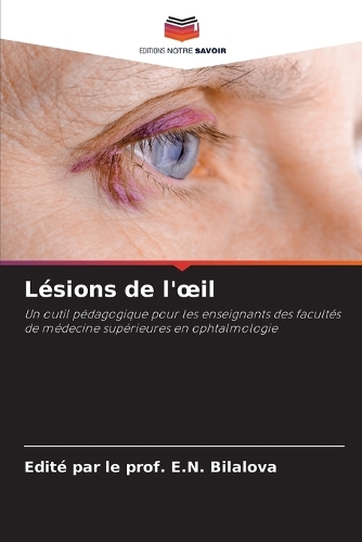 Lésions de l'oeil