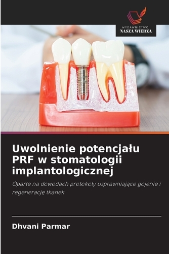Uwolnienie potencjalu PRF w stomatologii implantologicznej