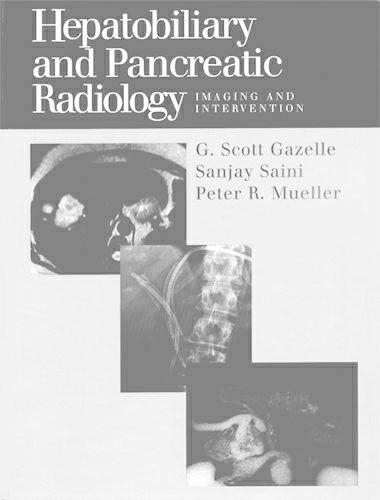 Hepatobiliary and Pancreatic Radiology: Imaging and Intervention