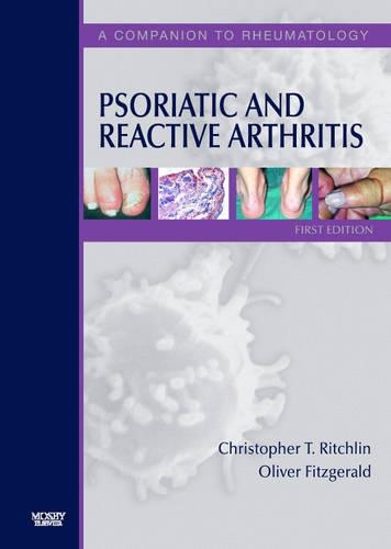 Psoriatic and Reactive Arthritis