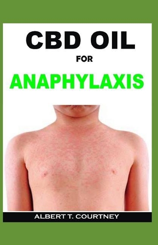 CBD Oil for Anaphylaxis: Learn about the Power of CBD Oil in Treating Anaphylaxis