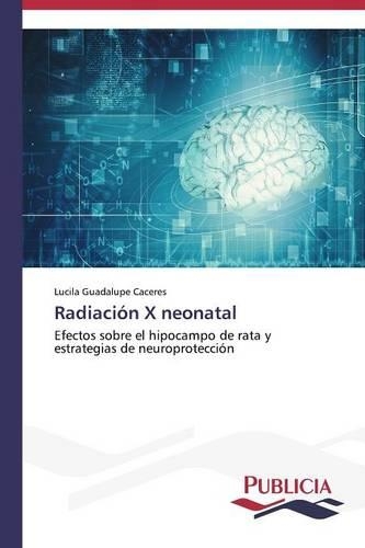 Radiación X neonatal