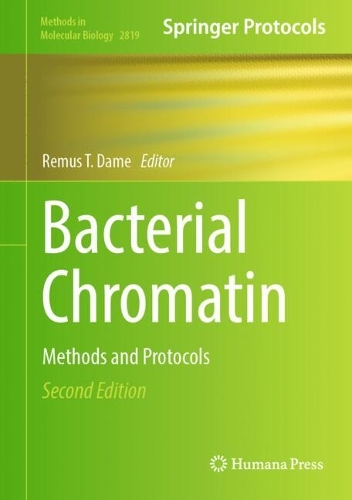 Bacterial Chromatin