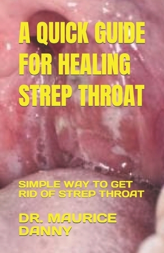 A Quick Guide for Healing Strep Throat: Simple Way to Get Rid of Strep Throat