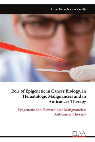 Role of Epigenetic in Cancer Biology, in Hematologic Malignancies and in Anticancer Therapy