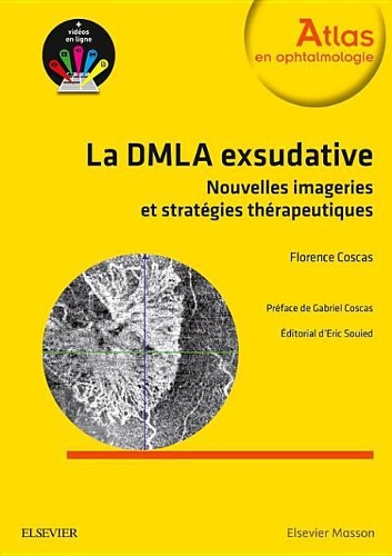 La Dmla Exsudative: Nouvelles Imageries Et Stratégies Thérapeutiques