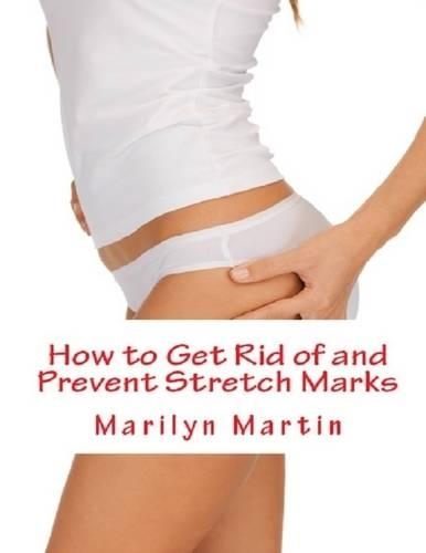 How to Get Rid of and Prevent Stretch Marks