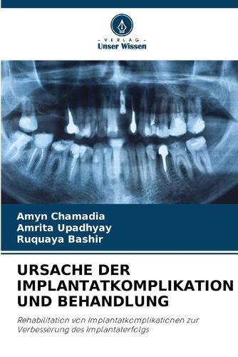 Ursache Der Implantatkomplikation Und Behandlung