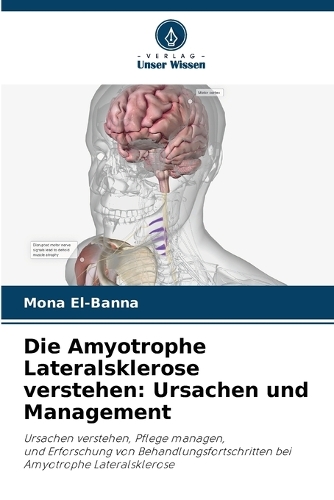 Die Amyotrophe Lateralsklerose verstehen: Ursachen und Management