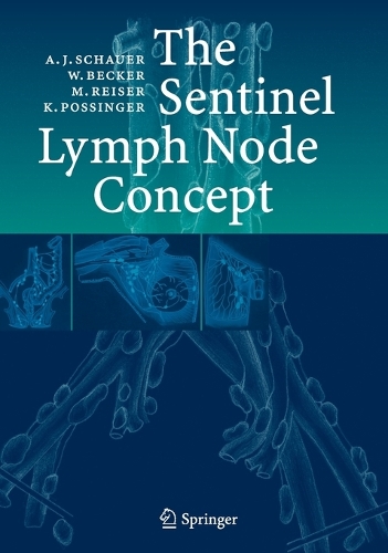 The Sentinel Lymph Node Concept