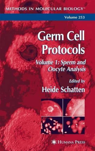Germ Cell Protocols: v.1 Sperm and Oocyte Analysis