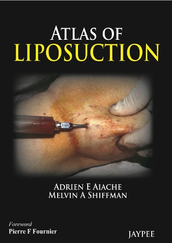 Atlas of Liposuction