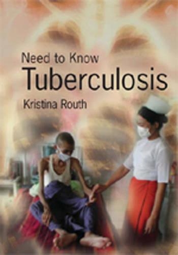 Need to Know: Tuberculosis: (Need to Know)