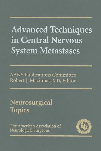 Advanced Techniques in Central Nervous System Metastases