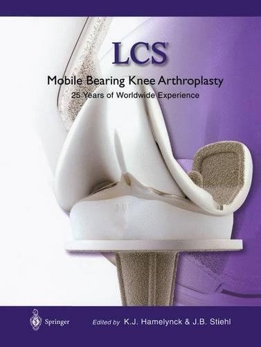 Lcs Mobile Bearing Knee Arthroplasty
