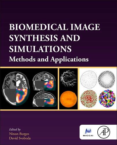 Biomedical Image Synthesis and Simulation: Methods and Applications(The MICCAI Society book Series)