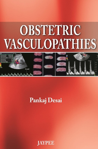 Obstetric Vasculopathies