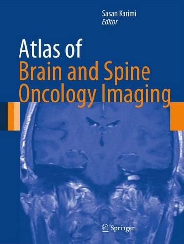 Atlas of Brain and Spine Oncology Imaging: (Atlas of Oncology Imaging)