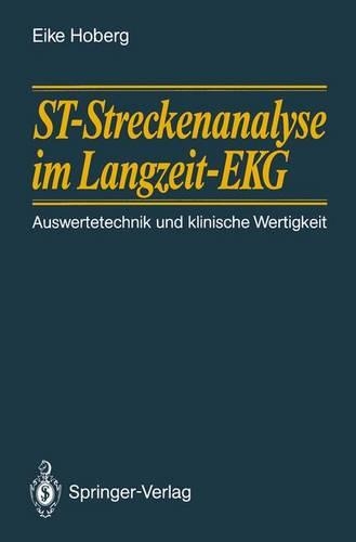 ST-Streckenanalyse im Langzeit-EKG: Auswertetechnik und klinische Wertigkeit