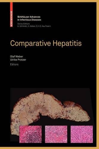 Comparative Hepatitis