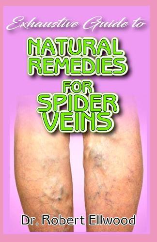 Exhaustive Guide To Natural Remedies for Spider Veins: A Simple guide to all there is to know about spider veins, its conventional treatments as well as its natural remedy! Discover the truth!