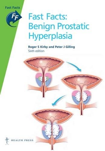 Fast Facts: Benign Prostatic Hyperplasia