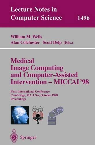 Medical Image Computing and Computer-Assisted Intervention - Miccai'98: First International Conference, Cambridge, Ma, USA, October 11-13, 1998, Proceedings(1496 Lecture Notes in Computer Science)