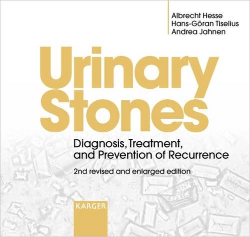 Urinary Stones