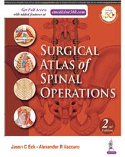 Surgical Atlas of Spinal Operations