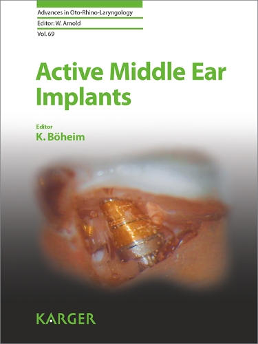 Active Middle Ear Implants: (69 Advances in Oto-Rhino-Laryngology)