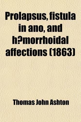Prolapsus, Fistula in Ano, and Haemorrhoidal Affections; Their Pathology and Treatment. Their Pathology and Treatment