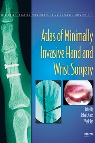 Atlas of Minimally Invasive Hand and Wrist Surgery: (Minimally Invasive Procedures in Orthopaedic Surgery)