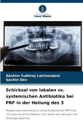 Schicksal von lokalen vs. systemischen Antibiotika bei PRF in der Heilung des 3