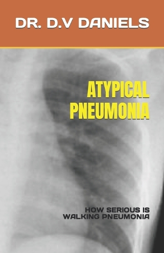 Atypical Pneumonia
