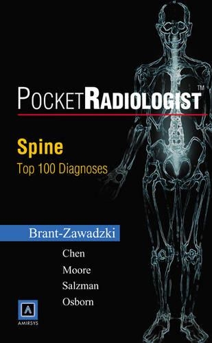 Spine: Top 100 Diagnoses(PocketRadiologist S.)