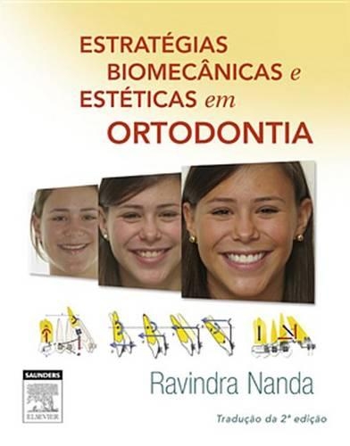 Estratégias Biomecânicas E Estéticas Em Ortodontia