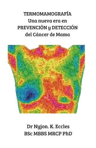 Termomamografía