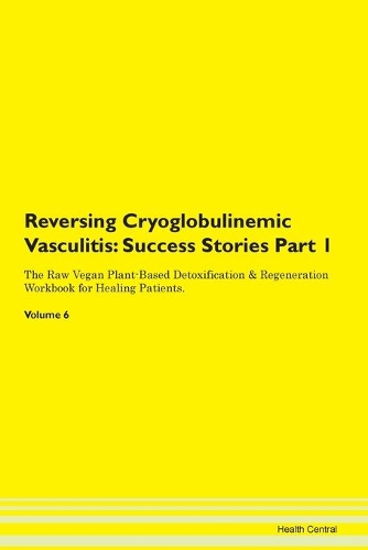 Reversing Cryoglobulinemic Vasculitis
