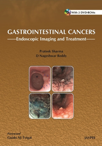 Gastrointestinal Cancers:: Endoscopic Imaging and Treatment