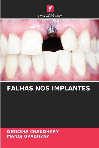 Falhas Nos Implantes